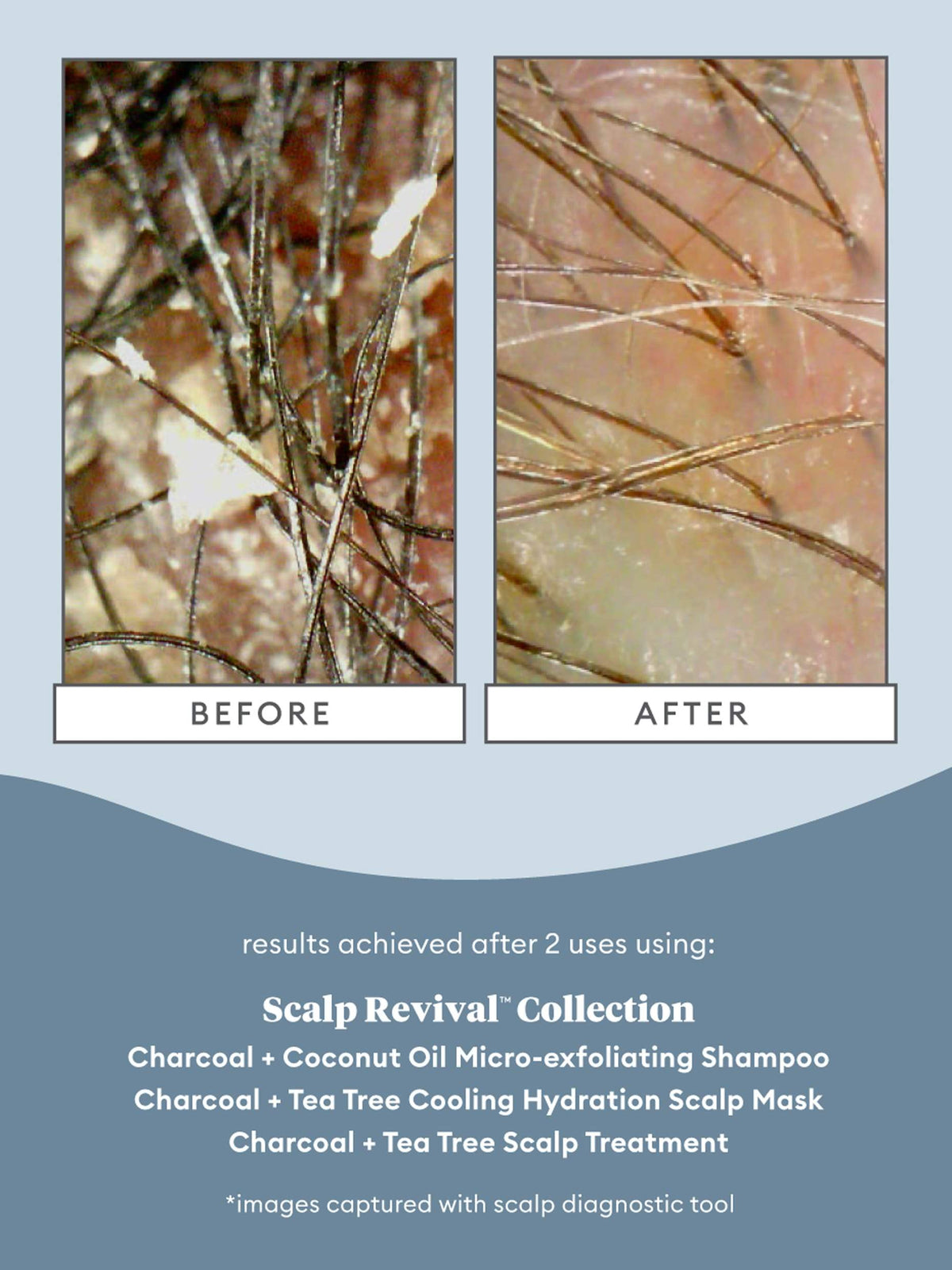 BRIOGEO Scalp Revival charcoal + tea tree scalp treatment زيت معالج الشعر